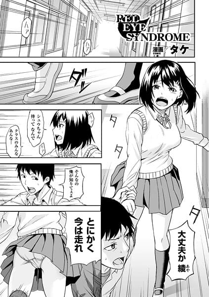 RED EYE SYNDROME【単話】