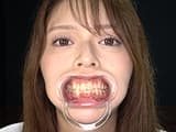 【口内・歯フェチ】人気女優の激レアな歯・治療跡・のどちんこ観察！