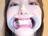 【口内】「人気女優 琥珀ややチャンの激レアの口内観察・のどちんこ観察・咀嚼！」琥珀やや（2）