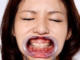 歯12