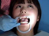 歯フェチ！処置室 つぐみちゃん 銀歯がキラリ