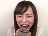 エリナちゃんの歯観察 『左上5番：涙の崩壊歯』