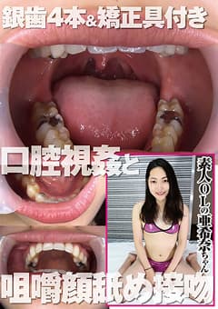 銀歯4本＆矯正具付き口腔視姦と咀嚼顔舐め接吻